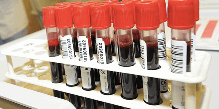 Alarmująco niski poziom zapasów krwi w Poznaniu. Brakuje aż pięciu grup!